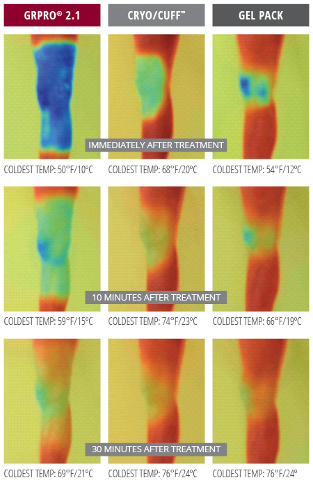 Thermal Imagery of Game Ready Wrap result